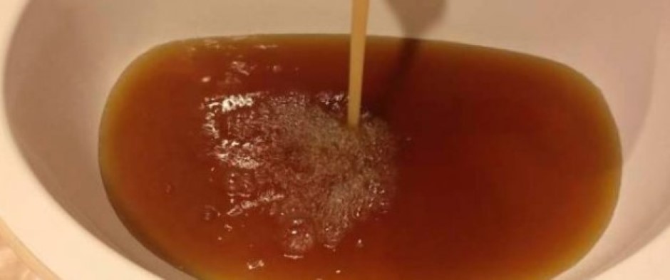 Well Water Laundry Issues and Pool Filtration